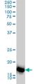 Sorting Nexin 12 antibody, H00029934-M01, Novus Biologicals, Western Blot image 