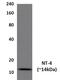 Neurotrophin 4 antibody, GTX53069, GeneTex, Western Blot image 