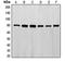 Ezrin antibody, orb214731, Biorbyt, Western Blot image 
