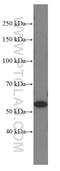 Nicotinamide Phosphoribosyltransferase antibody, 66385-1-Ig, Proteintech Group, Western Blot image 