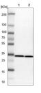 Actin Related Protein 2/3 Complex Subunit 2 antibody, NBP1-88852, Novus Biologicals, Western Blot image 