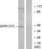 G Protein-Coupled Receptor 137C antibody, TA316306, Origene, Western Blot image 