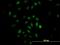 Tripartite Motif Containing 49 antibody, H00057093-M05, Novus Biologicals, Immunofluorescence image 