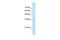 Lysosomal Protein Transmembrane 4 Alpha antibody, GTX46370, GeneTex, Western Blot image 