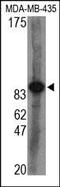 Argonaute RISC Catalytic Component 2 antibody, 200187, Abbiotec, Western Blot image 