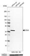 Cyclin Dependent Kinase 6 antibody, NBP1-87262, Novus Biologicals, Western Blot image 