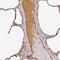 Complement Factor H Related 1 antibody, PA5-58592, Invitrogen Antibodies, Immunohistochemistry paraffin image 