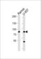 Zinc Finger CCCH-Type Containing 11A antibody, MBS9209883, MyBioSource, Western Blot image 