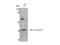 Beta-1,3-Galactosyltransferase 4 antibody, STJ96369, St John