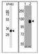 EPH Receptor B2 antibody, AM11064PU-N, Origene, Western Blot image 