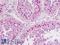 Cell Division Cycle 25B antibody, LS-B9050, Lifespan Biosciences, Immunohistochemistry paraffin image 