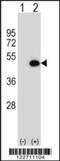 ILK Associated Serine/Threonine Phosphatase antibody, 62-090, ProSci, Western Blot image 