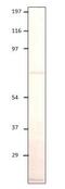 Interleukin 17 Receptor B antibody, GTX00640, GeneTex, Western Blot image 