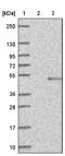 Fatty acid desaturase 1 antibody, NBP1-84312, Novus Biologicals, Western Blot image 