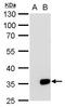 Galectin 8 antibody, PA5-34861, Invitrogen Antibodies, Western Blot image 