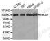 Protein Kinase N2 antibody, A4044, ABclonal Technology, Western Blot image 