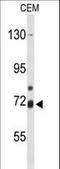 Arachidonate 15-Lipoxygenase Type B antibody, LS-C156290, Lifespan Biosciences, Western Blot image 