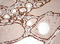 DOT1 Like Histone Lysine Methyltransferase antibody, LS-C336653, Lifespan Biosciences, Immunohistochemistry paraffin image 