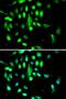 Cyclin Dependent Kinase 1 antibody, LS-C330847, Lifespan Biosciences, Immunofluorescence image 