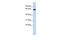Solute Carrier Family 1 Member 2 antibody, GTX47746, GeneTex, Western Blot image 