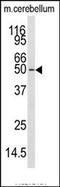 Calcium/Calmodulin Dependent Protein Kinase Kinase 1 antibody, AP14556PU-N, Origene, Western Blot image 