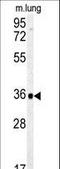 Carbonic Anhydrase 4 antibody, LS-C100688, Lifespan Biosciences, Western Blot image 