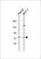 Decapping MRNA 1B antibody, 64-169, ProSci, Western Blot image 