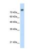 Minichromosome Maintenance Complex Component 6 antibody, NBP1-58075, Novus Biologicals, Western Blot image 