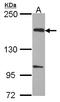 EvC Ciliary Complex Subunit 2 antibody, LS-C185907, Lifespan Biosciences, Western Blot image 