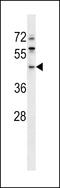 Exoribonuclease 1 antibody, LS-C167808, Lifespan Biosciences, Western Blot image 
