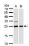 Glutathione S-Transferase Pi 1 antibody, NBP2-16756, Novus Biologicals, Western Blot image 