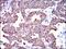 Keratin 5 antibody, GTX60749, GeneTex, Immunohistochemistry paraffin image 
