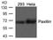 Paxillin antibody, 79-321, ProSci, Western Blot image 