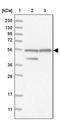 Heparan-Alpha-Glucosaminide N-Acetyltransferase antibody, PA5-56197, Invitrogen Antibodies, Western Blot image 