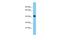 Myosin Light Chain Kinase Family Member 4 antibody, A13949, Boster Biological Technology, Western Blot image 