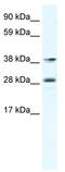 Myocyte Enhancer Factor 2B antibody, TA341792, Origene, Western Blot image 