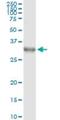 Distal-Less Homeobox 1 antibody, H00001745-M01, Novus Biologicals, Immunoprecipitation image 