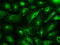 Glutamate Decarboxylase 1 antibody, M02002-1, Boster Biological Technology, Immunofluorescence image 