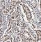 TDP-Glucose 4,6-Dehydratase antibody, FNab08636, FineTest, Immunohistochemistry paraffin image 