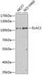 ElaC Ribonuclease Z 2 antibody, GTX32582, GeneTex, Western Blot image 