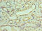 Interferon Induced Protein With Tetratricopeptide Repeats 3 antibody, CSB-PA011022HA01HU, Cusabio, Immunohistochemistry paraffin image 