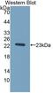 TIMP Metallopeptidase Inhibitor 1 antibody, abx130998, Abbexa, Western Blot image 