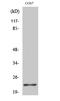 BCL2 Associated Agonist Of Cell Death antibody, STJ91801, St John