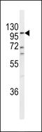 Endothelin Converting Enzyme 1 antibody, MBS9206114, MyBioSource, Western Blot image 