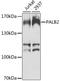 Partner And Localizer Of BRCA2 antibody, A8373, ABclonal Technology, Western Blot image 