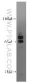 Sciellin antibody, 11906-1-AP, Proteintech Group, Western Blot image 