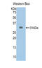 ATP Binding Cassette Subfamily A Member 1 antibody, LS-C292953, Lifespan Biosciences, Western Blot image 