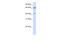 Cilia And Flagella Associated Protein 45 antibody, 26-601, ProSci, Enzyme Linked Immunosorbent Assay image 