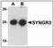 Synaptogyrin 3 antibody, AP23936PU-N, Origene, Western Blot image 