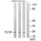 Tumor Protein, Translationally-Controlled 1 antibody, A03414, Boster Biological Technology, Western Blot image 